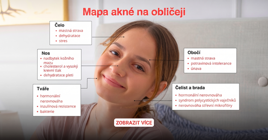 Mapa obličeje při akné podle zón