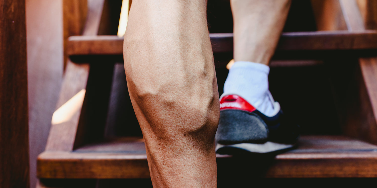 Křečové žíly a fitness – jak jim předejít