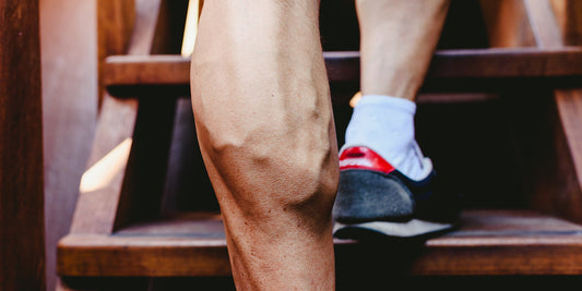 Křečové žíly a fitness – jak jim předejít