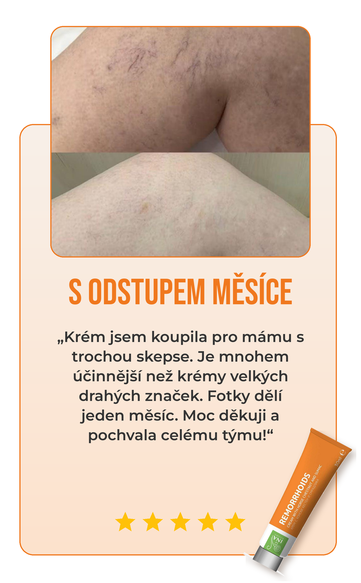 Recenze krému na žíly 1