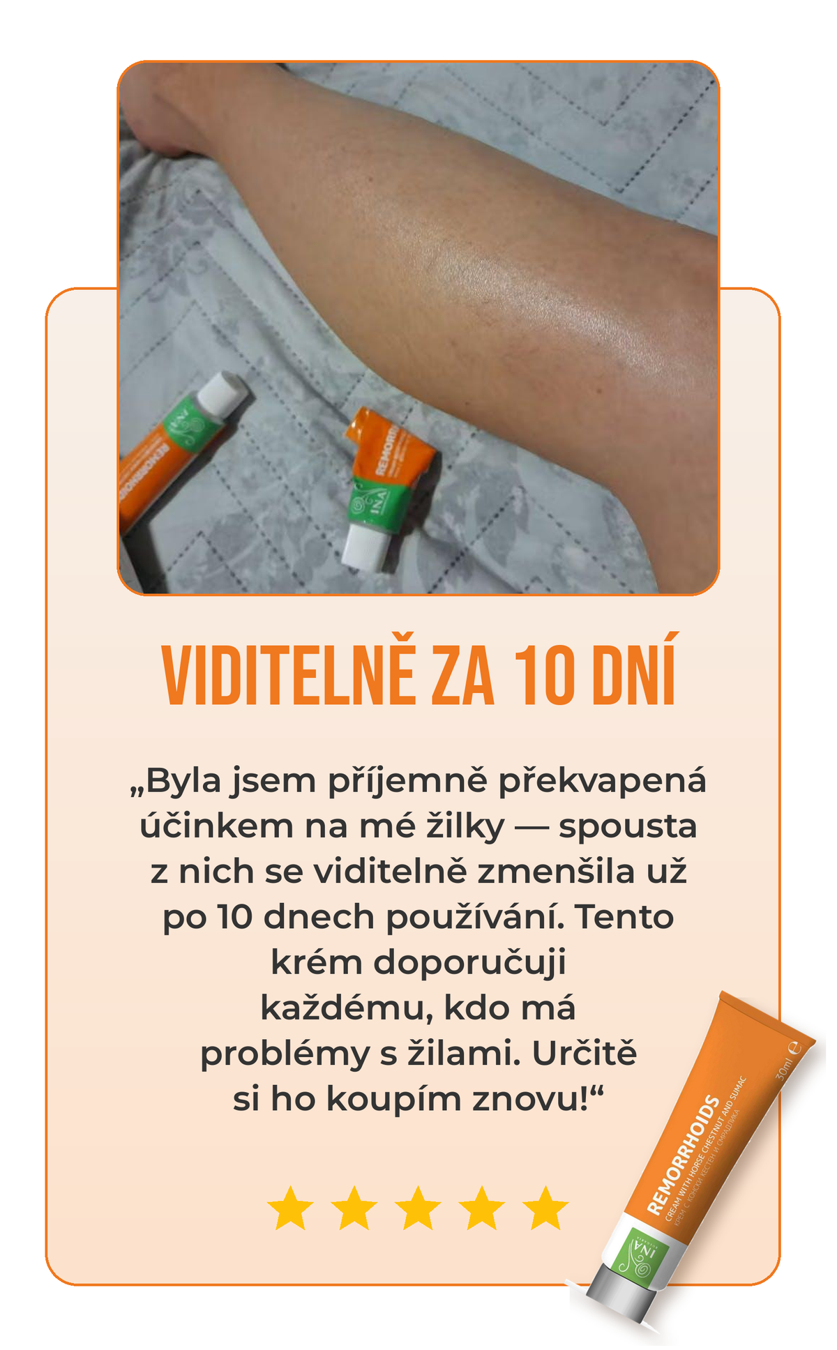Recenze krému na žíly 2
