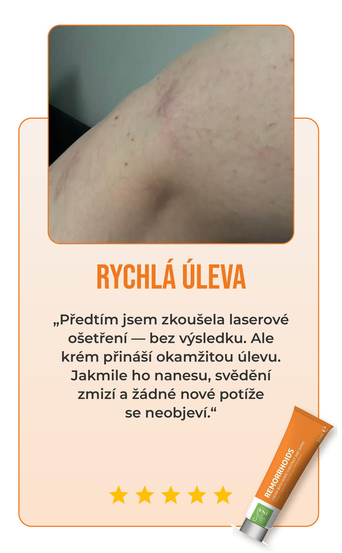 Recenze krému na žíly 3