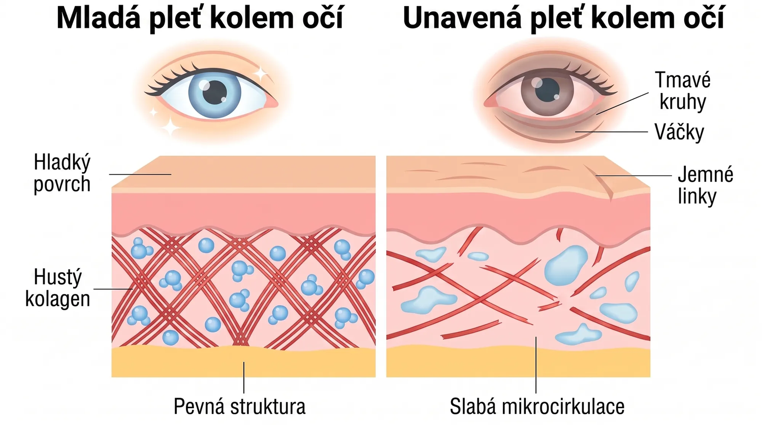 Rose Eye Lift CZ eyev1