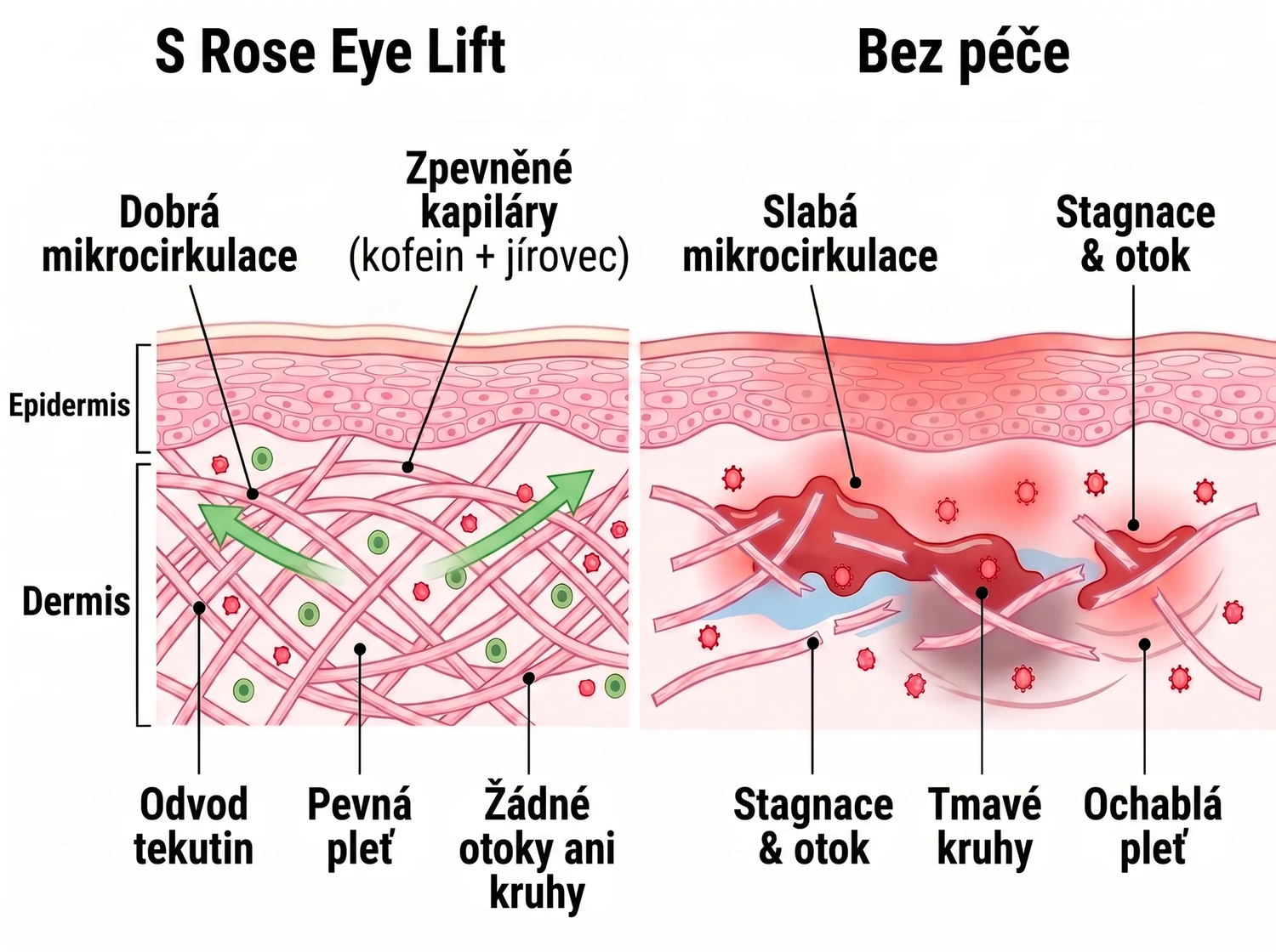 Rose Eye Lift CZ t17