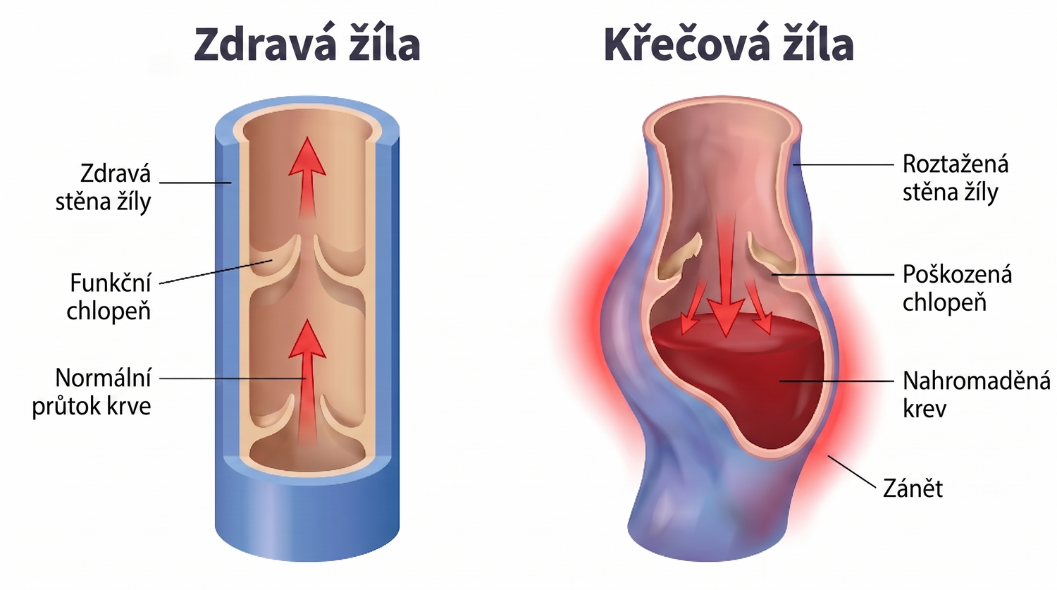 periodontis_cz