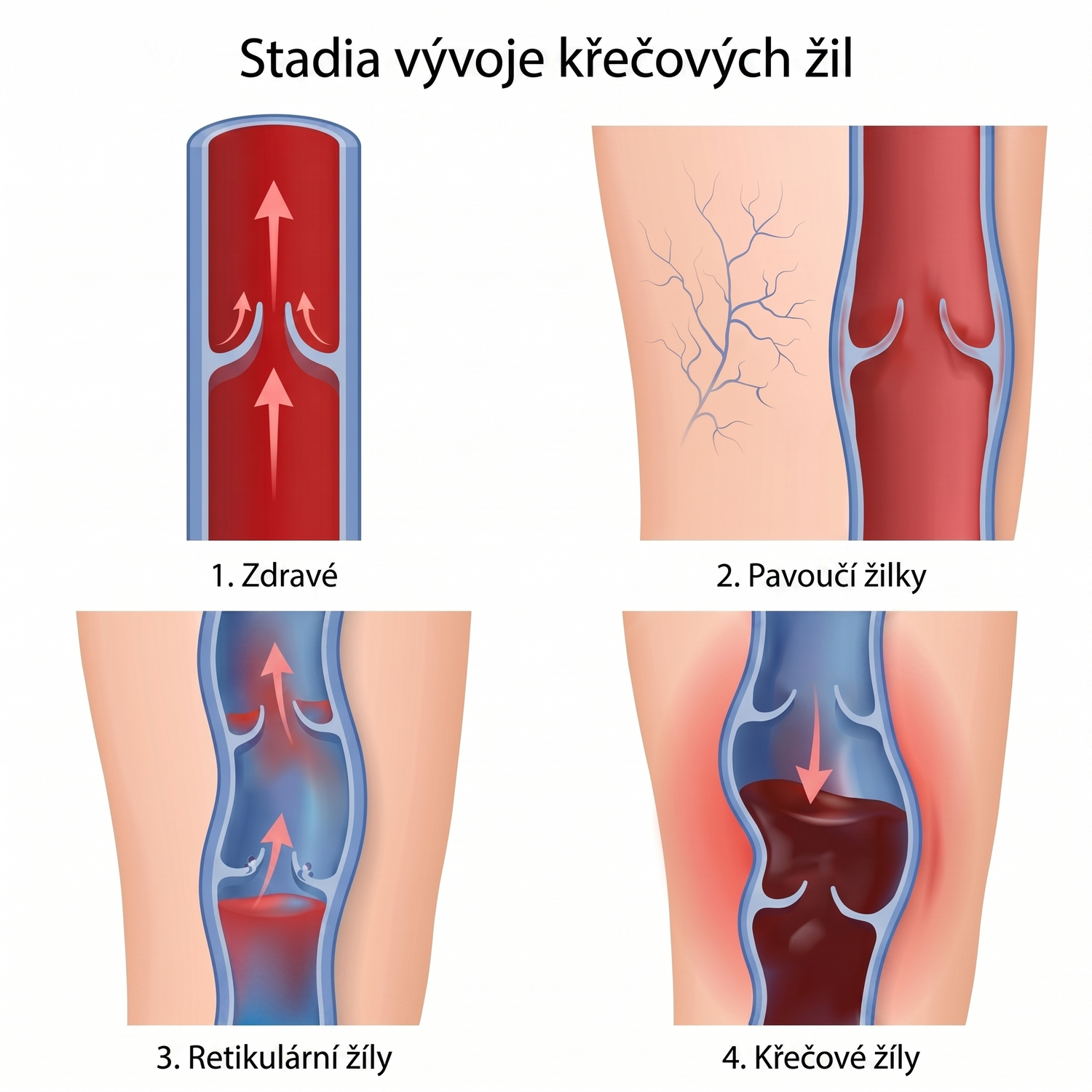 shutterstock_4stages_cz