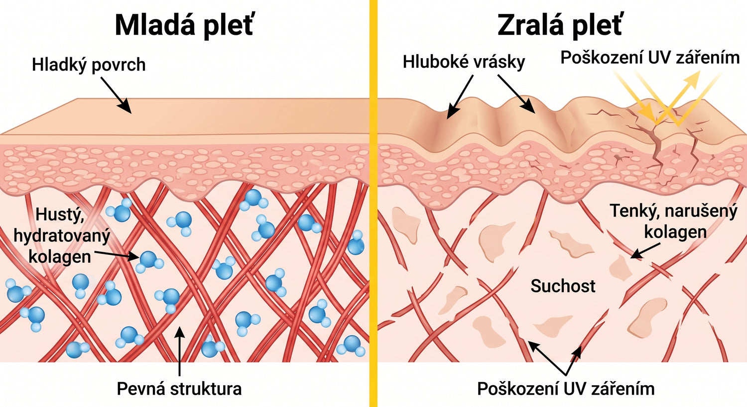 spf CZ infographic
