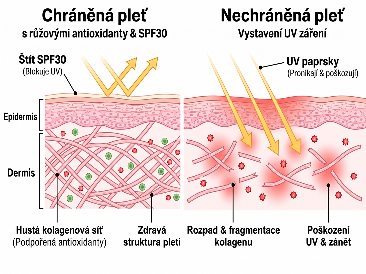 spf CZ infographic