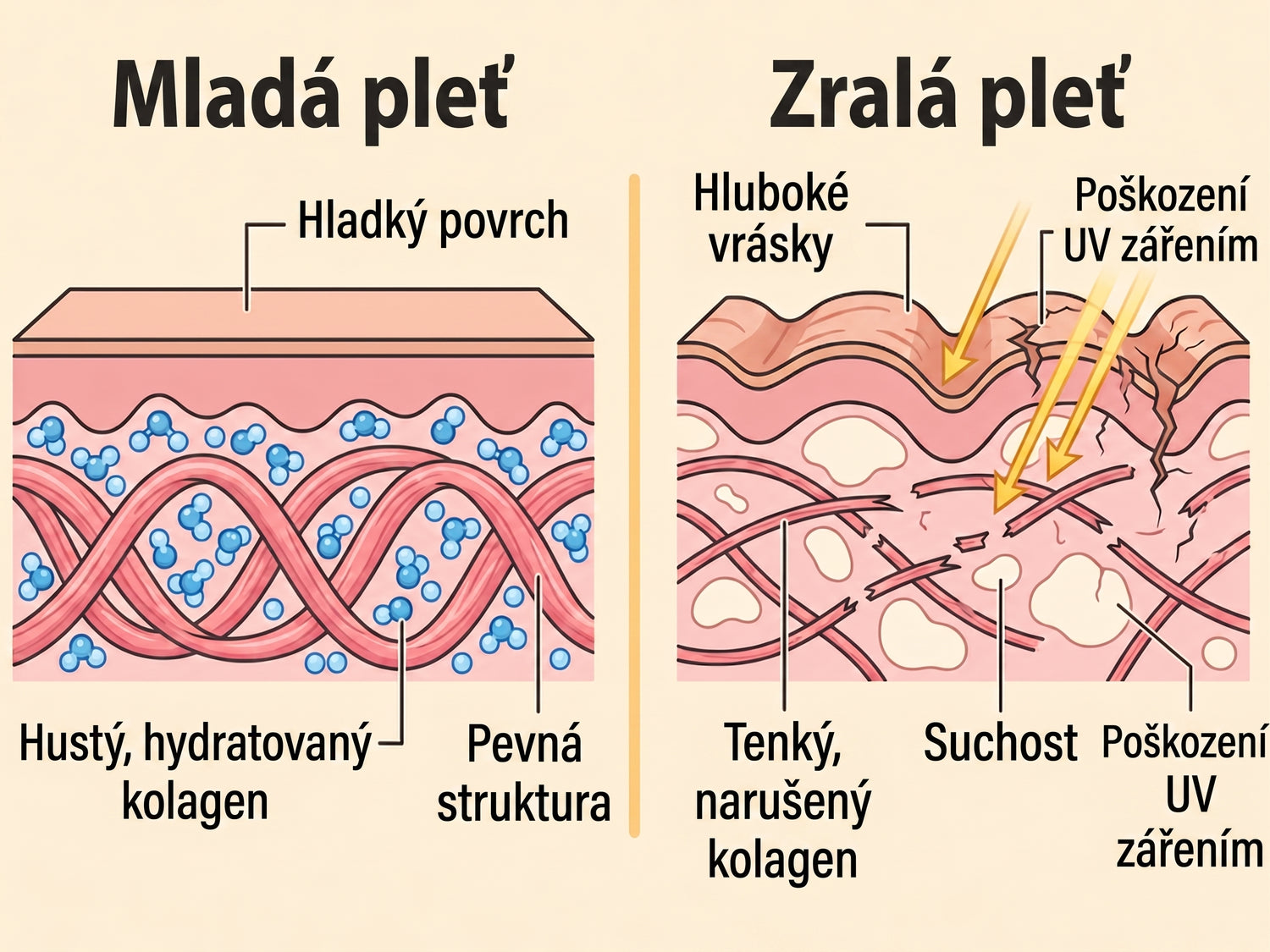 spf CZ infographic