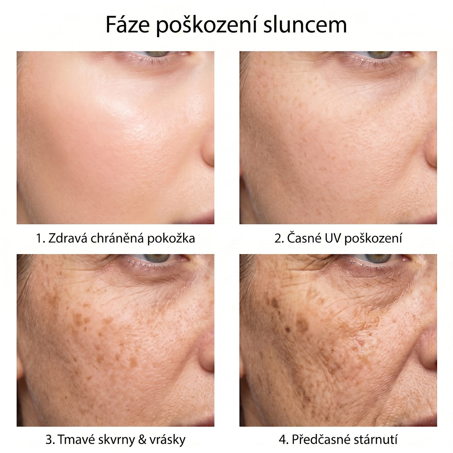 spf CZ infographic