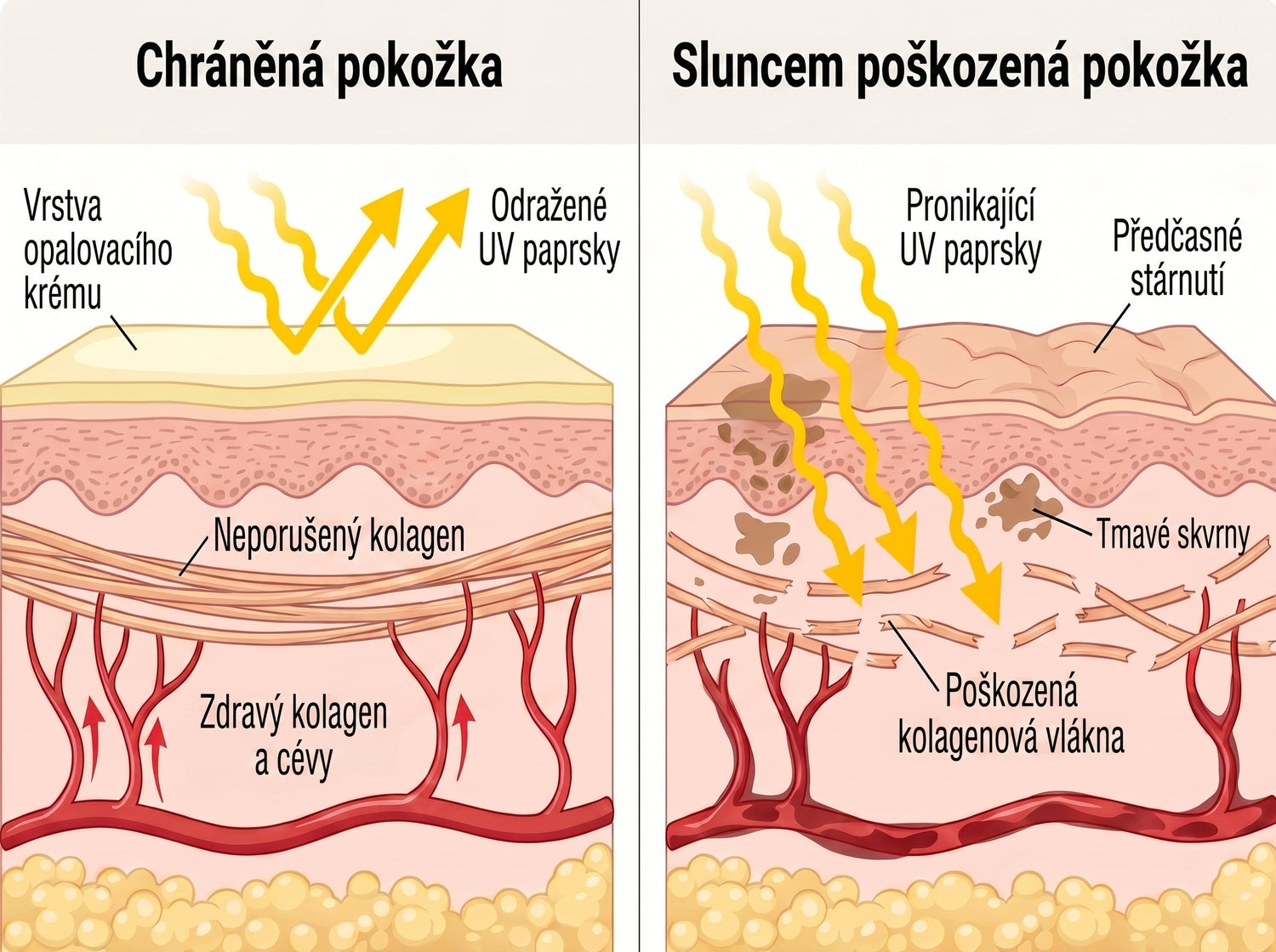 spf CZ infographic