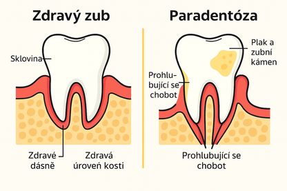 Kupte 3x Ústní Vodu z Divoké Ruje Vlasaté (Škumpa) + 1 Zubní Pastu Ina Dent-All - Rodinný balíček